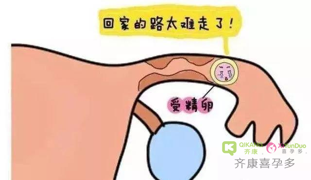 什么是输卵管堵塞？输卵管堵塞分为几级？