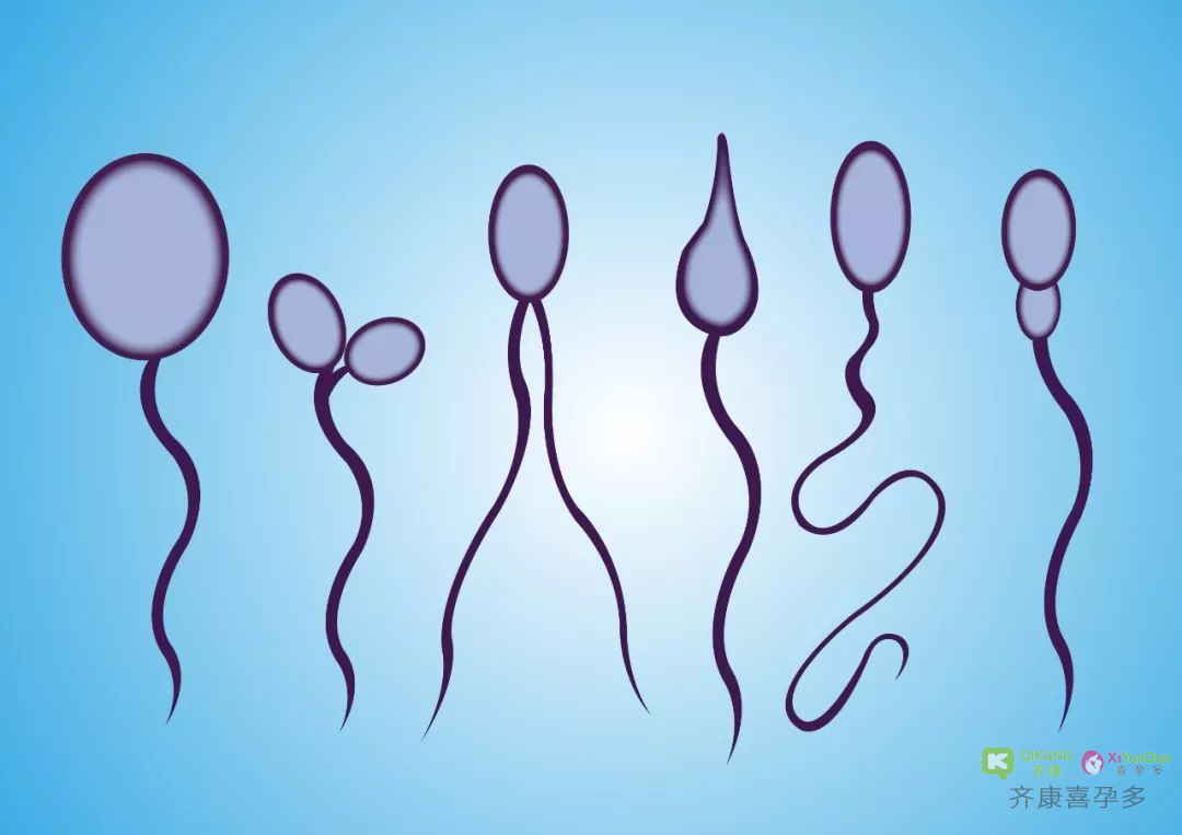什么是精子畸形？精子畸形可以试管吗？