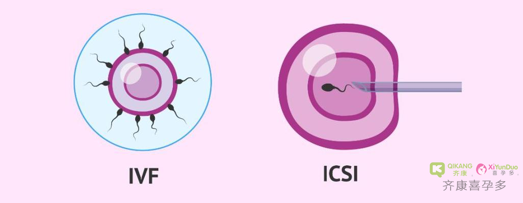 喜孕多告诉你：一代试管和二代试管区别在哪里？