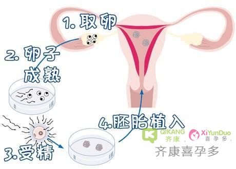 什么是试管婴儿？试管婴儿对女性到底有没有伤害？