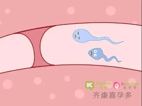 什么是输卵管堵塞？输卵管堵塞几代试管婴儿可以解决？