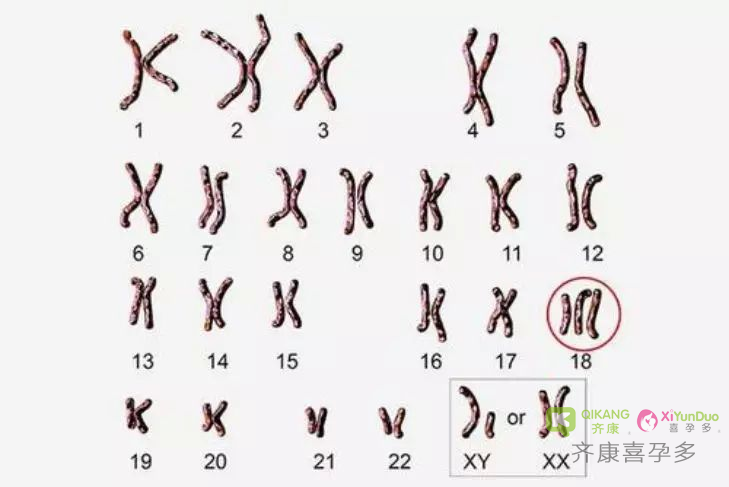 什么是染色体异常？染色体异常在深圳哪里可以做三代试管？