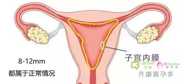 内膜为什么会变薄？什么样的内膜适合三代试管移植?